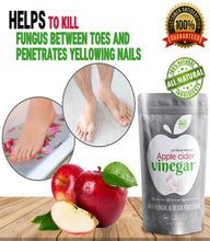 Load image into Gallery viewer, Apple Cider Vinegar Foot Soak &amp; Detox for Tired Achy Feet, Dry Skin, Calluses, and Athlete&#39;s Foot
